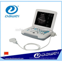 diagnostic sonography & ultrasonography &portable laptop ultrasound DW500